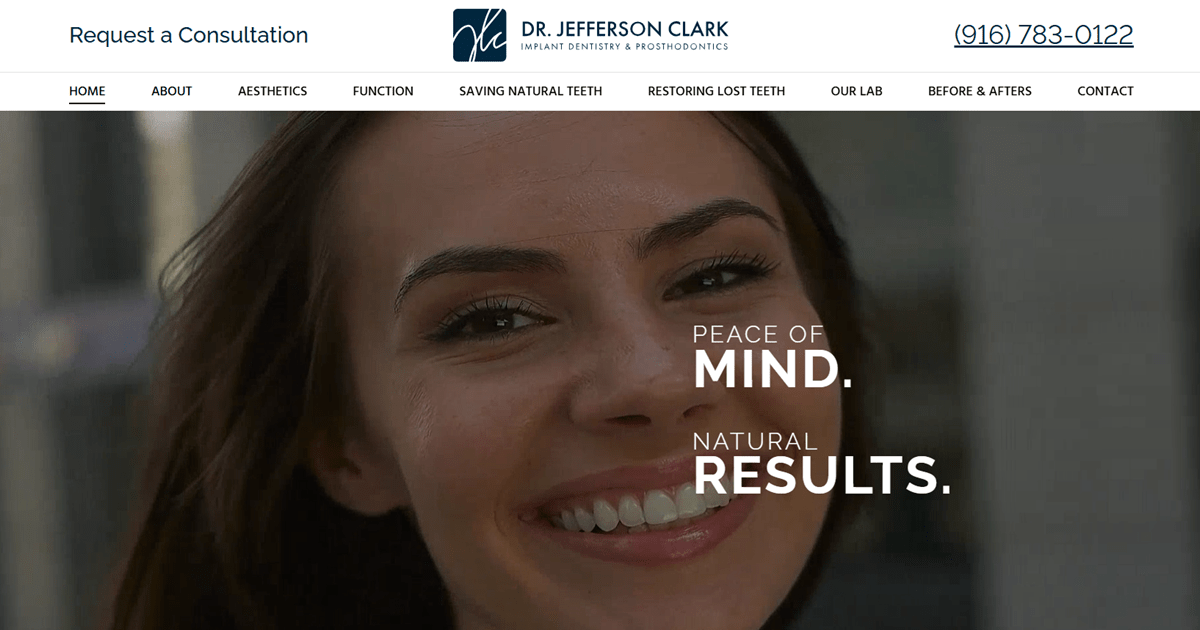 Website designed by Onspire for Dr. Jefferson Clark Implant Dentistry & Prosthodontics